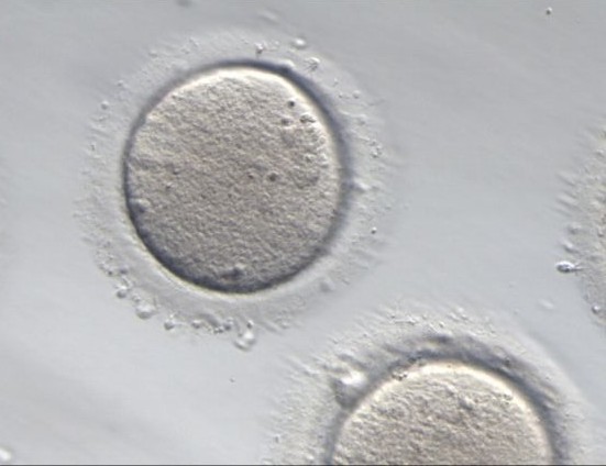 congelamento-de-ovulos