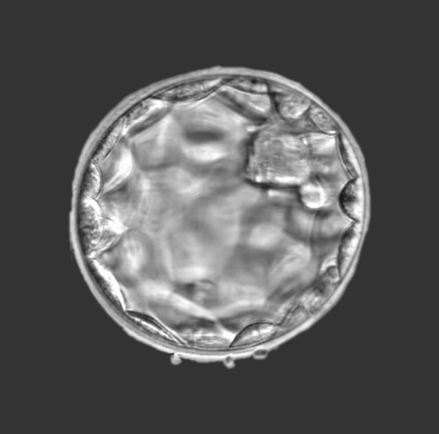 fertilizacao-in-vitro